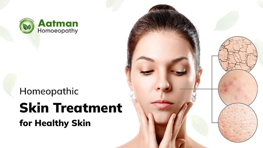 Homeopathic skin treatment for healthy skin 2 Homeopathic skin treatment for healthy skin