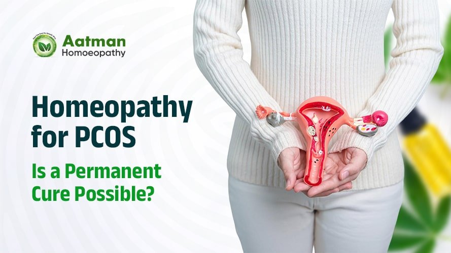 Homeopathy for PCOS: Is a Permanent Cure Possible?